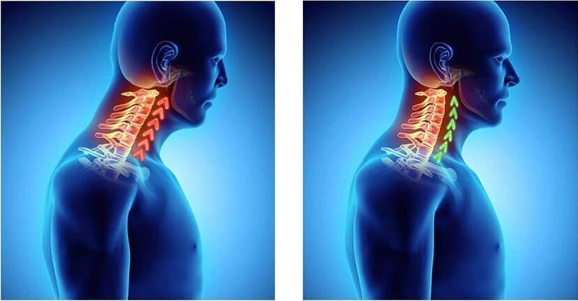 kulcscsont ízületi fájdalom a keresztcsonti gerinc osteochondrosisa